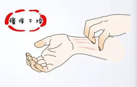 福州皮肤瘙痒去哪家医院_福州华研可靠么