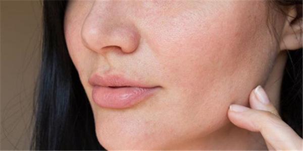 皮肤过敏了?福州皮肤科:要小心这五种皮肤病